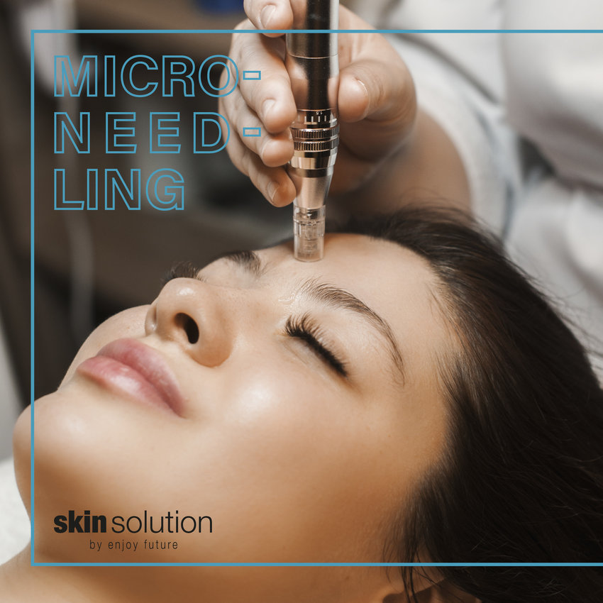 micro needling